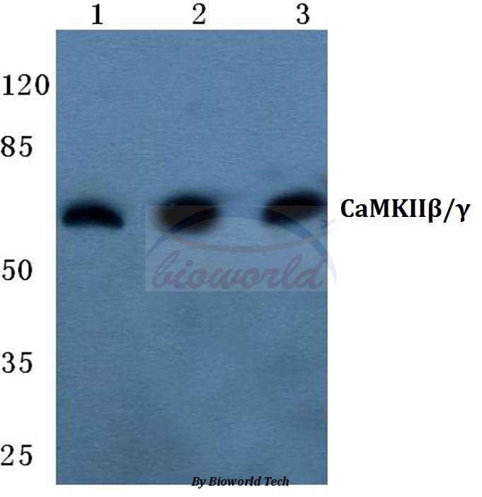 Western blot (WB) analysis of CaMKIIβ/γ (R631) pAb at 1:500 dilution Lane1:HEK293T cell lysate Lane2:Raw264.7 cell lysate Lane3:Rat colon tissue lysate