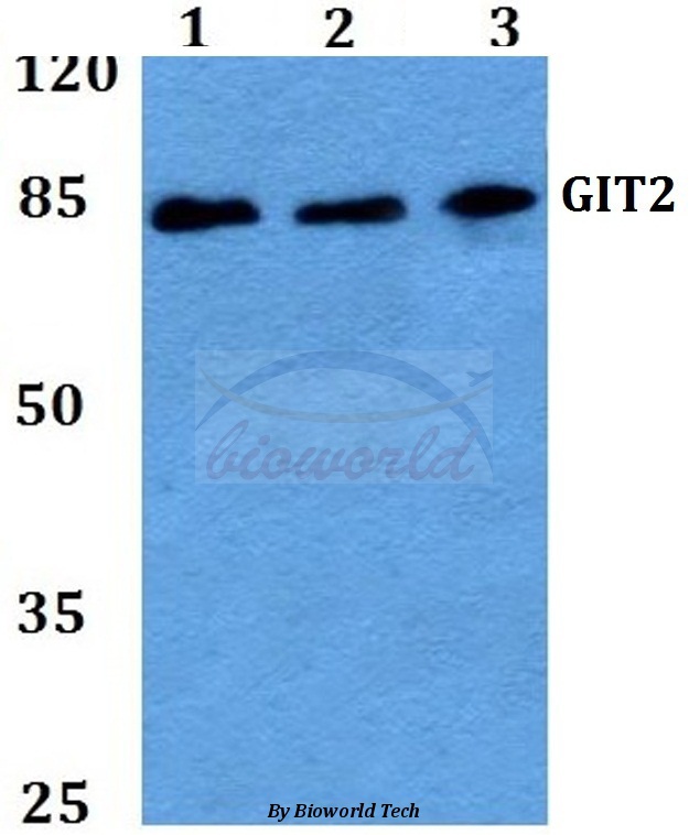 Western blot (WB) analysis of GIT2 (D391) pAb at 1:500 dilution Lane1:HEK293T whole cell lysate Lane2:sp2/0 whole cell lysate Lane3:H9C2 whole cell lysate