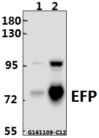 Western blot (WB) analysis of EFP (D222) pAb at 1:500 dilution Lane1:HEK293T whole cell lysate(40ug) Lane2:MCF-7 whole cell lysate(40ug)