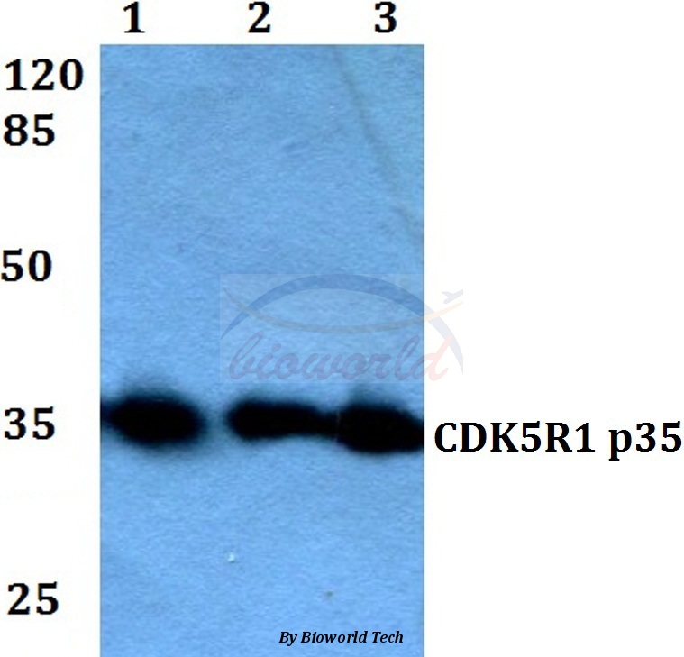 Western blot (WB) analysis of CDK5R1 (Q31) pAb at 1:500 dilution Lane1:MCF-7 whole cell lysate Lane2:Raw264.7 whole cell lysate Lane3:PC12 whole cell lysate