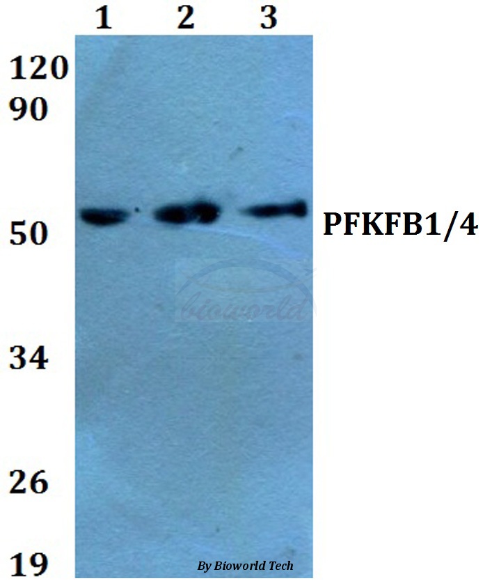 Western blot (WB) analysis of PFKFB1/4 (E349) pAb at 1:500 dilution Lane1:HEK293T cell lysate treated with serum(10%,1h) Lane2:sp2/0 cell lysate treated with serum(10%,1h) Lane3:H9C2 cell lysate treated with serum(10%,1h)