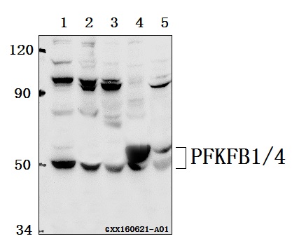 Western blot (WB) analysis of PFKFB1/4 (E349) pAb at 1:500 dilution Lane1:A549 whole cell lysate(40ug) Lane2:HepG2 whole cell lysate(40ug) Lane3:The Lung tissue lysate of Mouse(40ug) Lane4:The Testis tissue lysate of Rat(40ug) Lane5:The Lung tissue lysate