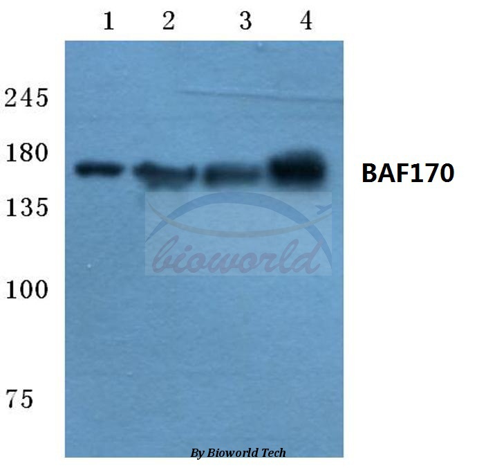 Western blot (WB) analysis of BAF170 (M388) pAb at 1:500 dilution Lane1:HEK293T cell lysate Lane2:Mouse liver tissue lysate Lane3:Rat liver tissue lysate Lane4:MCF-7 cell lysate