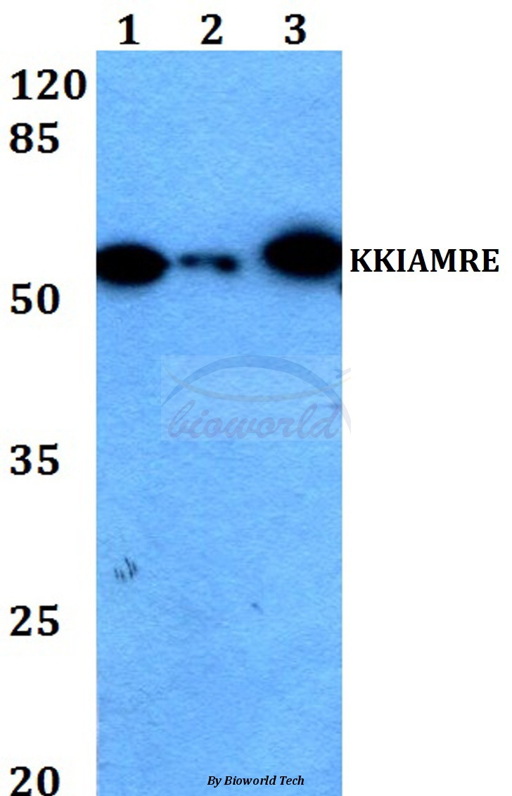 Western blot (WB) analysis of KKIAMRE (L240) pAb at 1:500 dilution Lane1:HEK293T whole cell lysate Lane2:Raw264.7 whole cell lysate Lane3:H9C2 whole cell lysate
