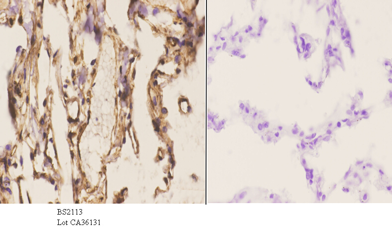 Immunohistochemistry (IHC) analyzes of KKIAMRE (L240) pAb in paraffin-embedded human lung carcinoma tissue at 1:50.showing cytoplasmic and nucleus staining. Negative control (the right)Using PBS instead of primary antibody, secondary antibody is Goat Anti-Rabbit IgG-biotin followed by avidin-peroxidase.