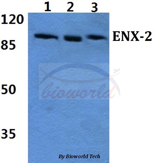 Western blot (WB) analysis of ENX-2 (E192) pAb at 1:500 dilution Lane1:HepG2 cell lysate Lane2:Mouse liver tissue lysate Lane3:Rat liver tissue lysate