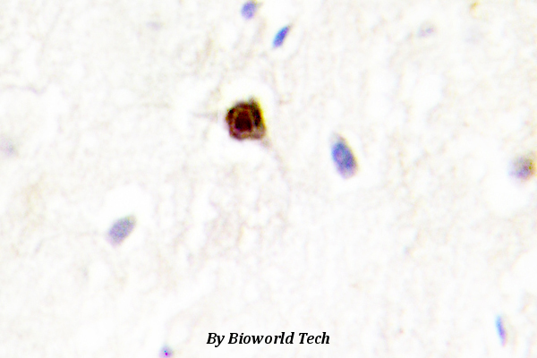 Immunohistochemistry (IHC) analyzes of ENX-2 (E192) pAb in paraffin-embedded human brain tissue.