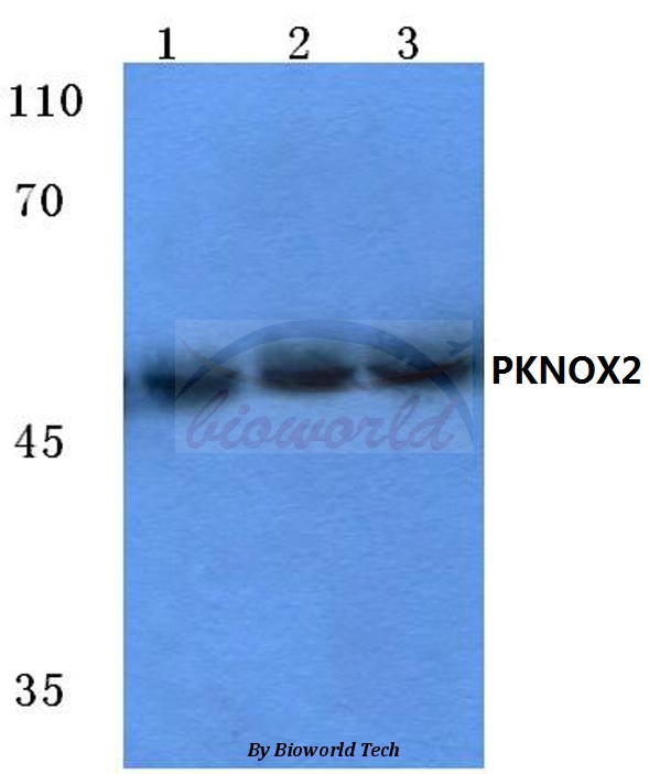 Western blot (WB) analysis of PKNOX2 (K361) pAb at 1:500 dilution Lane1:Hela cell lysate Lane2:Mouse kidney tissue lysate Lane3:Rat kidney tissue lysate