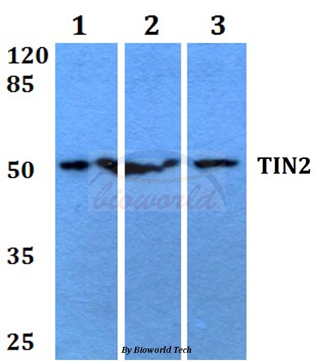 Western blot (WB) analysis of TIN2 (V94) pAb at 1:500 dilution Lane1:HEK293T whole cell lysate Lane2:Raw264.7 whole cell lysate Lane3:H9C2 whole cell lysate