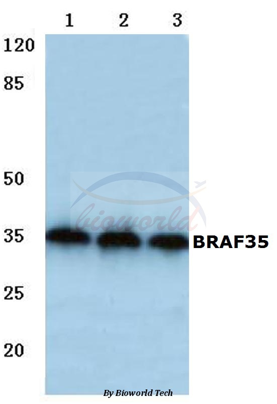 Western blot (WB) analysis of BRAF35 (T29) pAb at 1:500 dilution Lane1:A549 cell lysate Lane2:Mouse liver tissue lysate Lane3:Rat liver tissue lysate