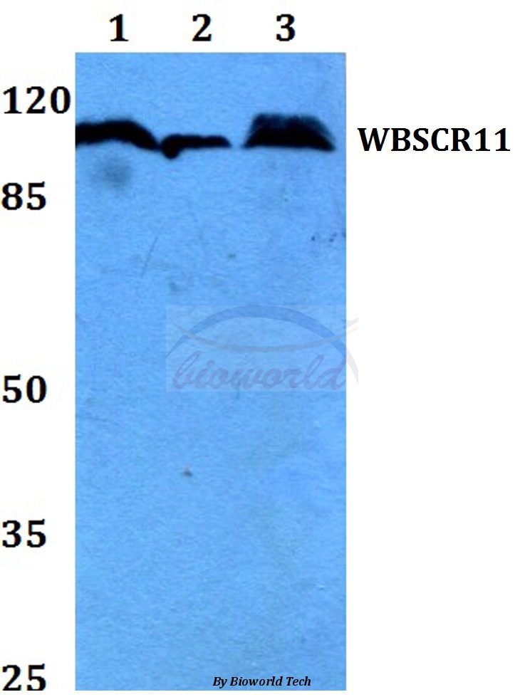 Western blot (WB) analysis of WBSCR11 (K94) pAb at 1:500 dilution Lane1:HEK293T whole cell lysate Lane2:Raw264.7 whole cell lysate Lane3:H9C2 whole cell lysate