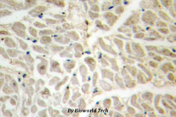 Immunohistochemistry (IHC) analyzes of FoxD3 (R233) pAb in paraffin-embedded human heart tissue.