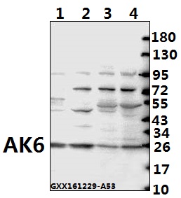 Western blot (WB) analysis of AK6 (G35) pAb at 1:500 dilution Lane1:H1792 whole cell lysate(40ug) Lane2:COS-7 whole cell lysate(40ug) Lane3:C6 whole cell lysate(40ug) Lane4:BV2 whole cell lysate(40ug)