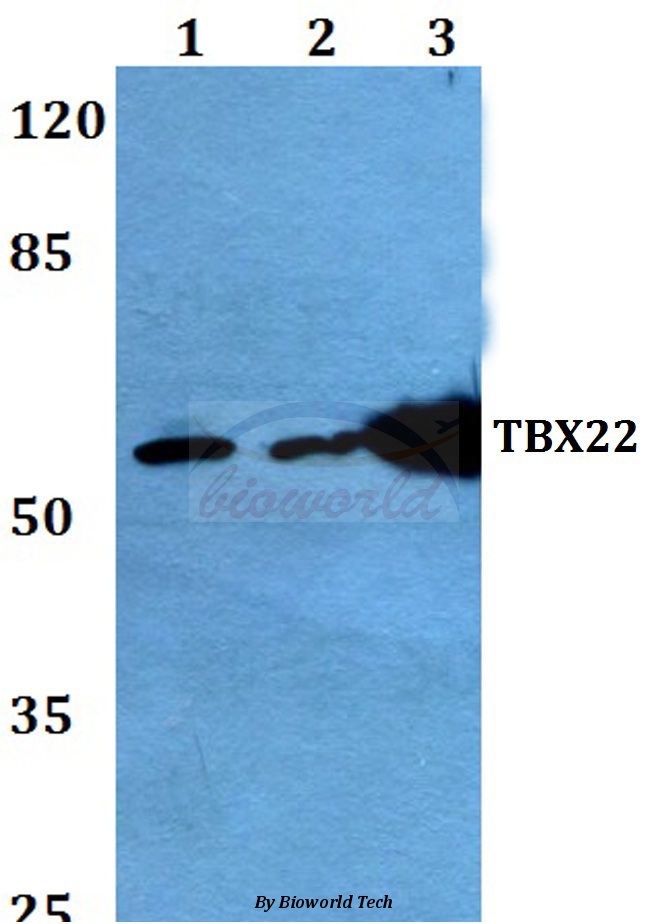 Western blot (WB) analysis of TBX22 (A30) pAb at 1:500 dilution Lane1:HEK293T whole cell lysate Lane2:Mouse lung tissue lysate Lane3:Rat lung tissue lysate
