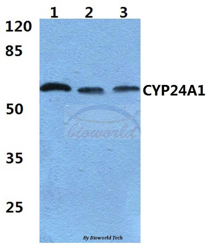 Western blot (WB) analysis of CYP24A1 (R439) pAb at 1:500 dilution Lane1:MCF-7 cell lysate Lane2:sp2/0 cell lysate Lane3:H9C2 cell lysate