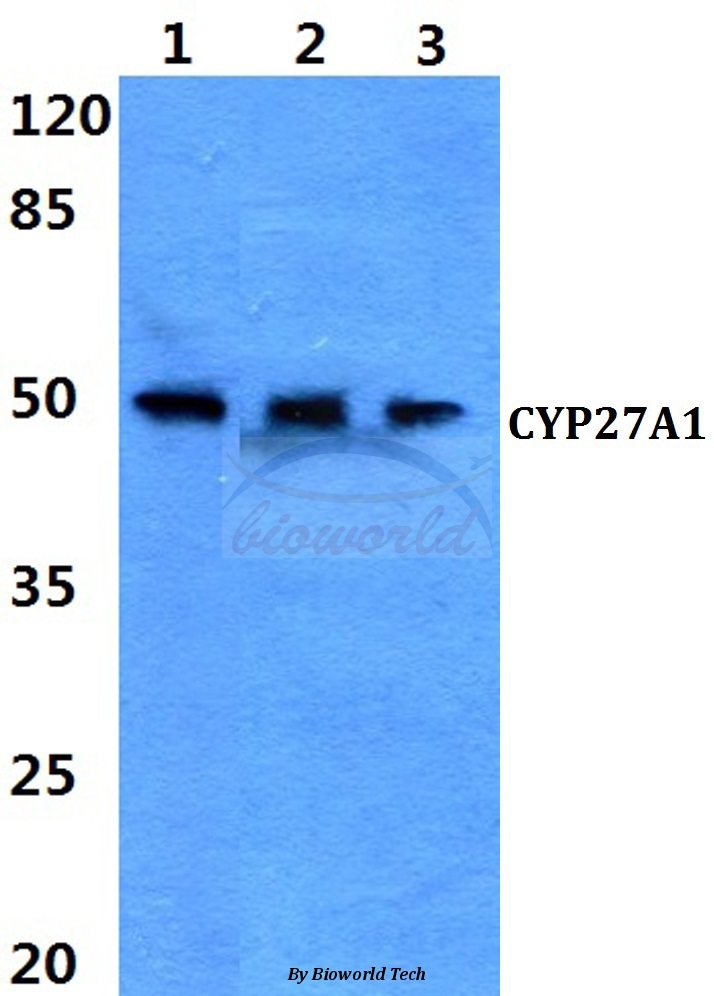 Western blot (WB) analysis of CYP27A1 (E131) pAb at 1:500 dilution Lane1:Hela cell lysate Lane2:Raw264.7 cell lysate Lane3:PC12 cell lysate