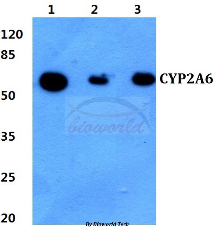 Western blot (WB) analysis of CYP2A6 (E131) pAb at 1:500 dilution Lane1:Hela cell lysate Lane2:Raw264.7 cell lysate Lane3:PC12 cell lysate