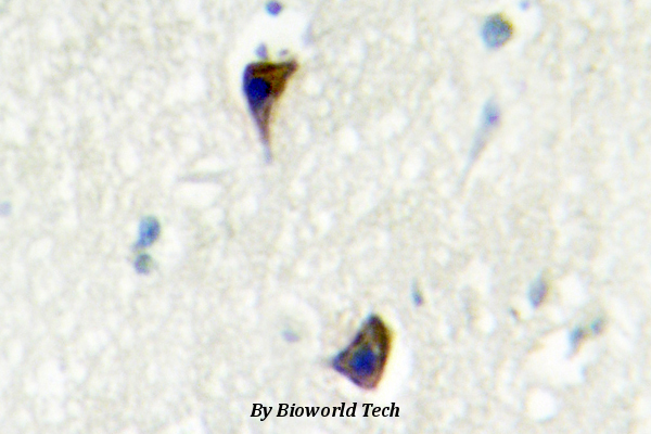 Immunohistochemistry (IHC) analyzes of AR-α1A (Q365) pAb in paraffin-embedded human brain tissue.