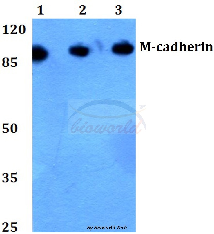 Western blot (WB) analysis of M-cadherin (A108) pAb at 1:500 dilution Lane1:HEK293T whole cell lysate Lane2:Mouse brain tissue lysate Lane3:Rat brain tissue lysate