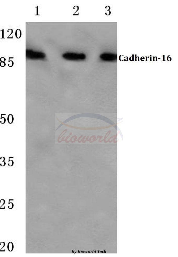 Western blot (WB) analysis of Cadherin-16 (M810) pAb at 1:500 dilution Lane1:HEK293T cell lysate Lane2:Mouse liver tissue lysate Lane3:Rat kidney tissue lysate