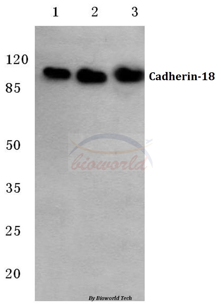 Western blot (WB) analysis of Cadherin-18 (Q129) pAb at 1:500 dilution Lane1:MCF-7 cell lysate Lane2:Mouse liver tissue lysate Lane3:Rat liver tissue lysate