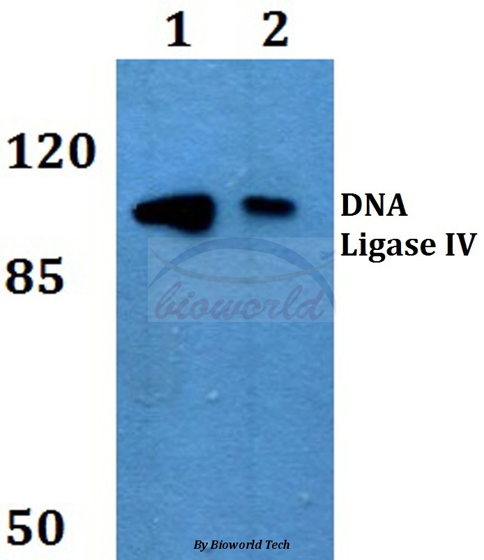 Western blot (WB) analysis of DNA Ligase IV (G619) pAb at 1:500 dilution Lane1:MCF-7 whole cell lysate Lane2:sp2/0 whole cell lysate