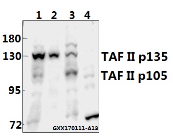 Western blot (WB) analysis of TAF II p135/p105 (E977) pAb at 1:500 dilution Lane1:A2780 whole cell lysate(40ug) Lane2:The Ovary tissue lysate of Rat(40ug) Lane3:SK-OVCAR3 whole cell lysate(40ug) Lane4:CT26 whole cell lysate(40ug)