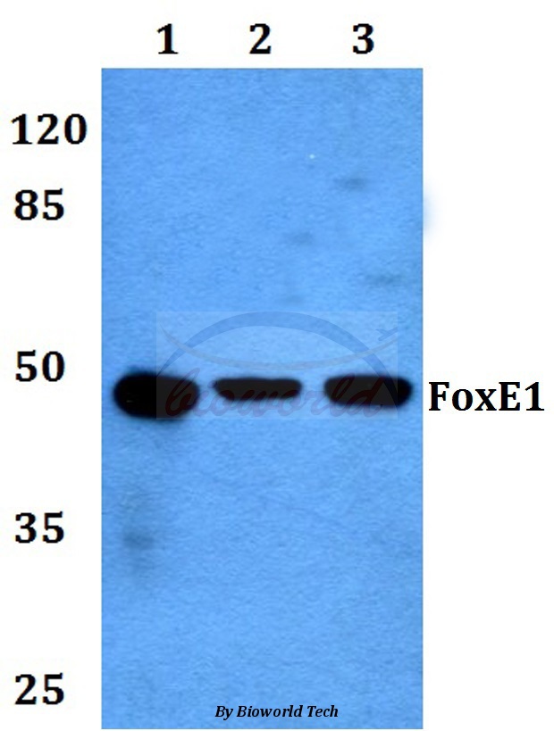 Western blot (WB) analysis of FoxE1 (Q11) pAb at 1:500 dilution Lane1:HEK293T whole cell lysate Lane2:sp2/0 whole cell lysate Lane3:PC12 whole cell lysate