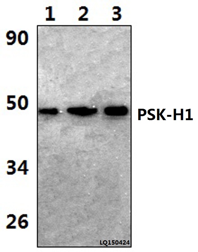 Western blot (WB) analysis of PSK-H1 (M295) pAb at 1:1000 dilution Lane1:NIH3T3 whole cell lysate(48ug) Lane2:RAW264.7 whole cell lysate(57ug) Lane3:H9C2 whole cell lysate(37ug)