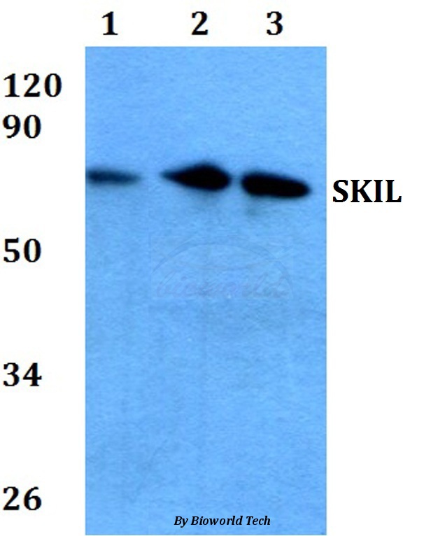Western blot (WB) analysis of SKIL (D652) pAb at 1:500 dilution Lane1:MCF-7 whole cell lysate Lane2:Raw264.7 whole cell lysate Lane3:PC12 whole cell lysate