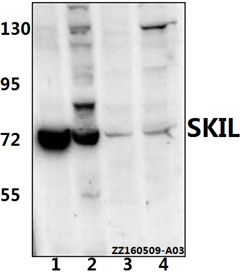 Western blot (WB) analysis of SKIL (D652) pAb at 1:500 dilution Lane1:HEK293T whole cell lysate(20ug) Lane2:A549 whole cell lysate(20ug) Lane3:The liver tissue lysate of Mouse(40ug) Lane4:The liver tissue lysate of Rat(40ug)
