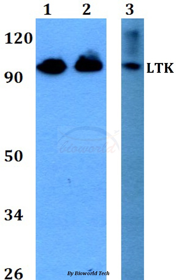 Western blot (WB) analysis of LTK (R241) pAb at 1:500 dilution Lane1:A549 whole cell lysate Lane2:NIH-3T3 whole cell lysate Lane3:PC12 whole cell lysate
