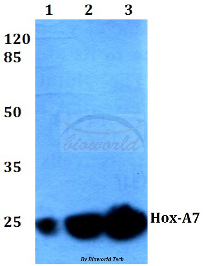 Western blot (WB) analysis of Hox-A7 (G127) pAb at 1:500 dilution Lane1:HEK293T whole cell lysate Lane2:Raw264.7 whole cell lysate Lane3:H9C2 whole cell lysate