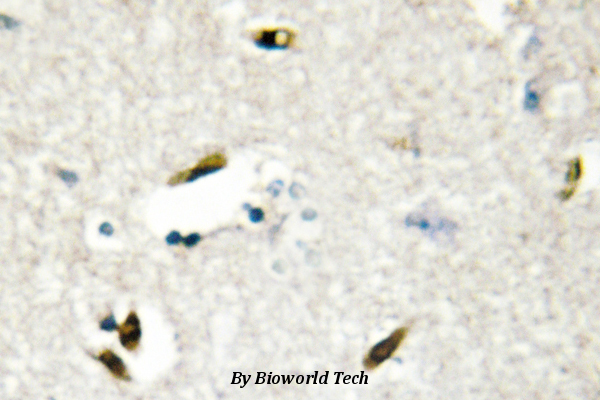 Immunohistochemistry (IHC) analyzes of hnRNP G (M40) pAb in paraffin-embedded human brain tissue.