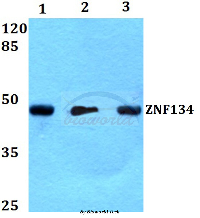 Western blot (WB) analysis of ZNF134 (K72) pAb at 1:500 dilution Lane1:HEK293T whole cell lysate Lane2:Raw264.7 whole cell lysate Lane3:H9C2 whole cell lysate