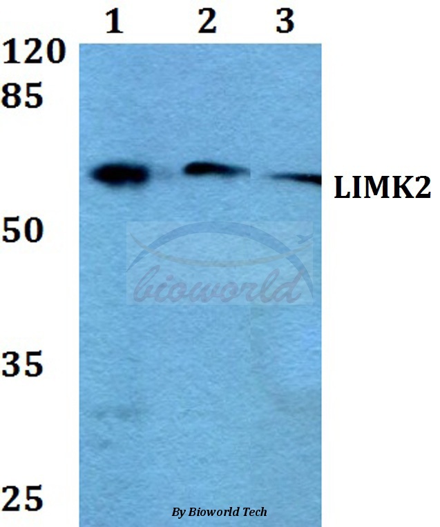 Western blot (WB) analysis of LIMK2 (K491) pAb at 1:500 dilution Lane1:A549 whole cell lysate Lane2:Raw264.7 whole cell lysate Lane3:PC12 whole cell lysate