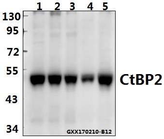 Western blot (WB) analysis of CtBP2 (P432) pAb at 1:500 dilution Lane1:HEK293A cell lysate Lane2:sp2/0 cell lysate Lane3:H9C2 cell lysate