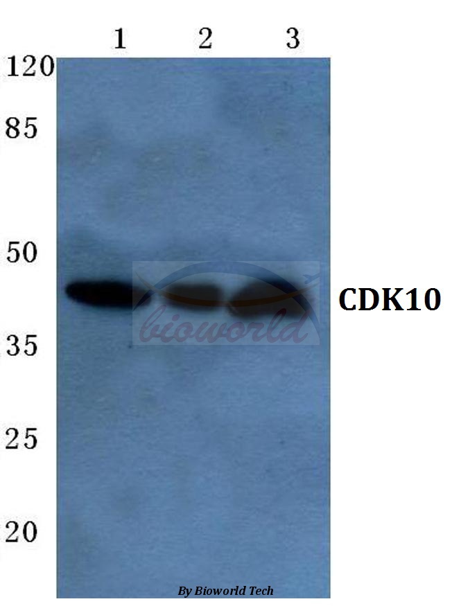 Western blot (WB) analysis of Cdk10 (E63) pAb at 1:500 dilution Lane1:Hela cell lysate Lane2:Raw264.7 cell lysate Lane3:Rat liver tissue lysate