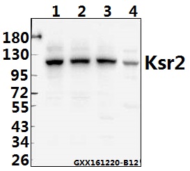 Western blot (WB) analysis of Ksr2 (I694) pAb at 1:500 dilution Lane1:HEK293T whole cell lysate(40ug) Lane2:A549 whole cell lysate(40ug) Lane3:AML-12 whole cell lysate(40ug) Lane4:C6 whole cell lysate(40ug)