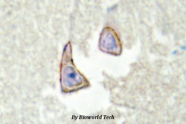 Immunohistochemistry (IHC) analyzes of Ksr2 (I694) pAb in paraffin-embedded human brain tissue. .