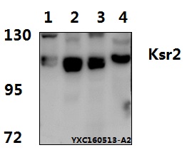 Western blot (WB) analysis of Ksr2 (I694) pAb at 1:1000 dillution Lane1:HEK293T whole cell lysate(40μg) Lane2:U-87MG whole cell lysate(40μg) Lane3:C6 whole cell lysate(40μg) Lane4:The Brain tissue lysate of Mouse (40μg)