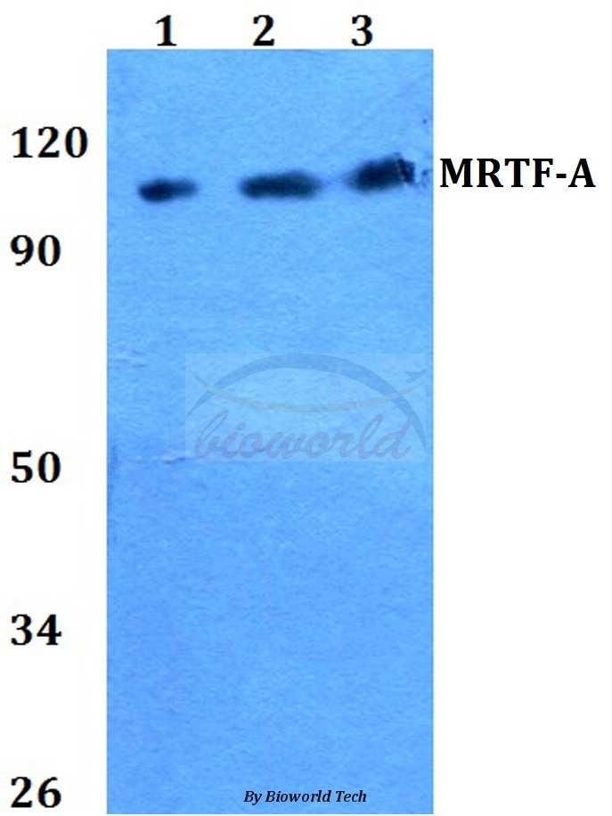 Western blot (WB) analysis of MRTF-A (H11) pAb at 1:500 dilution Lane1:HEK293T whole cell lysate Lane2:Raw264.7 whole cell lysate Lane3:PC12 whole cell lysate
