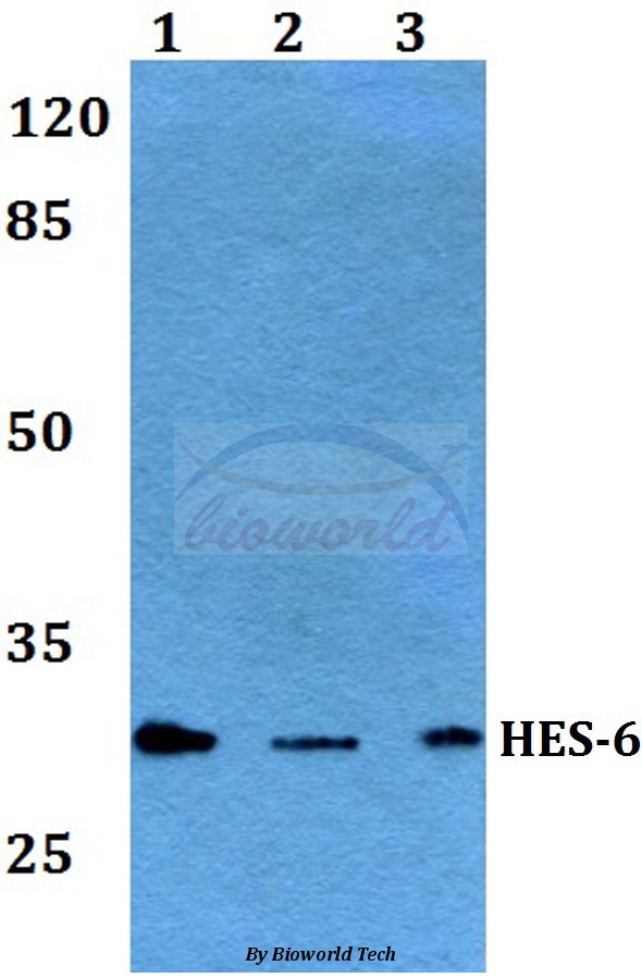 Western blot (WB) analysis of HES-6 (A6) pAb at 1:500 dilution Lane1:Hela whole cell lysate Lane2:NIH-3T3 whole cell lysate Lane3:PC12 whole cell lysate