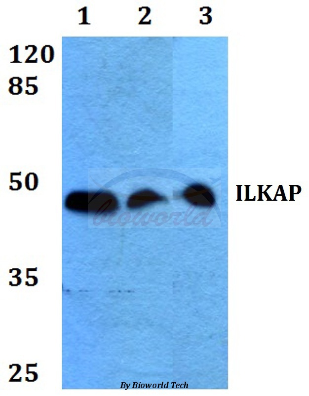 Western blot (WB) analysis of ILKAP (K71) pAb at 1:500 dilution Lane1:HEK293T whole cell lysate Lane2:sp2/0 whole cell lysate Lane3:H9C2 whole cell lysate