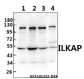 Western blot (WB) analysis of ILKAP (K71) pAb at 1:500 dilution Lane1:L02 whole cell lysate(40ug) Lane2:HCT116 whole cell lysate(40ug) Lane3:AML-12 whole cell lysate(40ug) Lane4:PMVEC whole cell lysate(40ug)