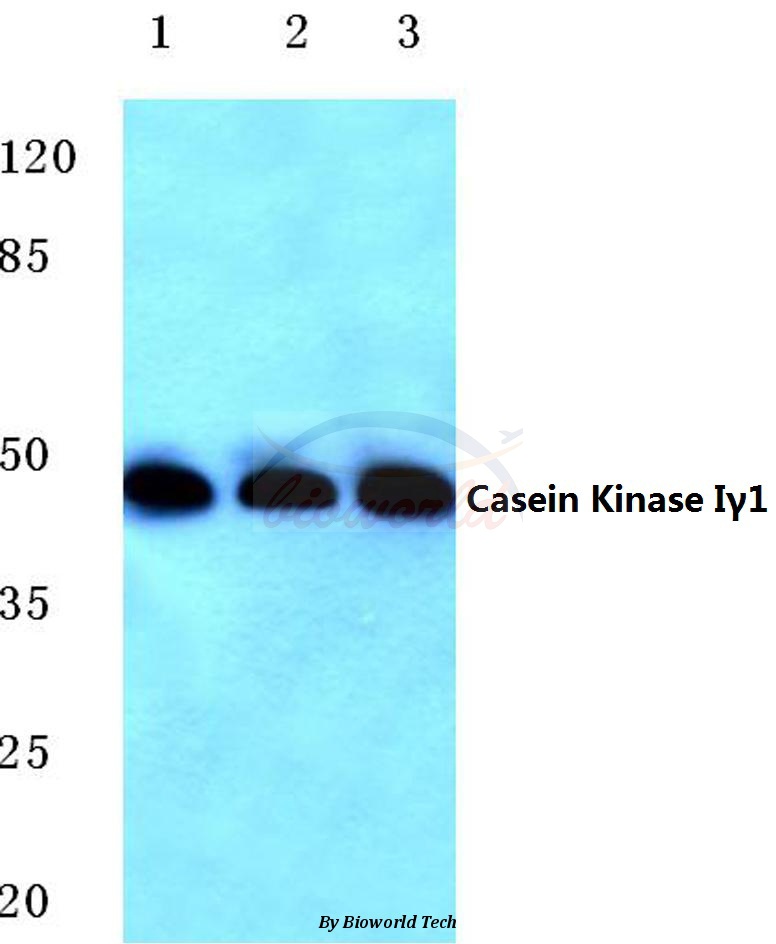 Western blot (WB) analysis of Casein Kinase Iγ1 (H3) pAb at 1:500 dilution Lane1:Jurkat cell lysate Lane2:NIH-3T3 cell lysate Lane3:H9C2 cell lysate