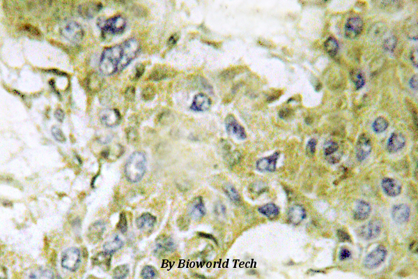 Immunohistochemistry (IHC) analyzes of Casein Kinase Iγ1 (H3) pAb in paraffin-embedded human brain tissue.