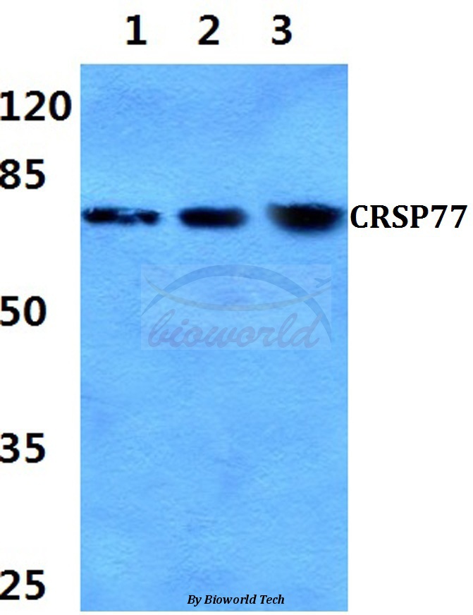 Western blot (WB) analysis of CRSP77 (V171) pAb at 1:500 dilution Lane1:A549 cell lysate Lane2:HepG2 cell lysate Lane3:Mouse spleen tissue lysate