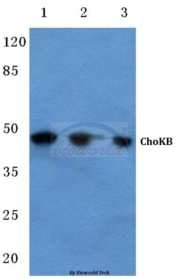 Western blot (WB) analysis of ChoKB (E324) pAb at 1:500 dilution Lane1:MCF-7 cell lysate Lane2:Raw264.7 cell lysate Lane3:Rat liver tissue lysate