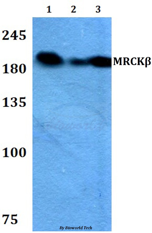 Western blot (WB) analysis of MRCKβ (F1665) pAb at 1:500 dilution Lane1:HEK293T whole cell lysate Lane2:Raw264.7 whole cell lysate Lane3:H9C2 whole cell lysate